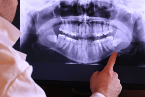 Best Emergency Treatment for Jaw Pain or Injury in Lacon, IL